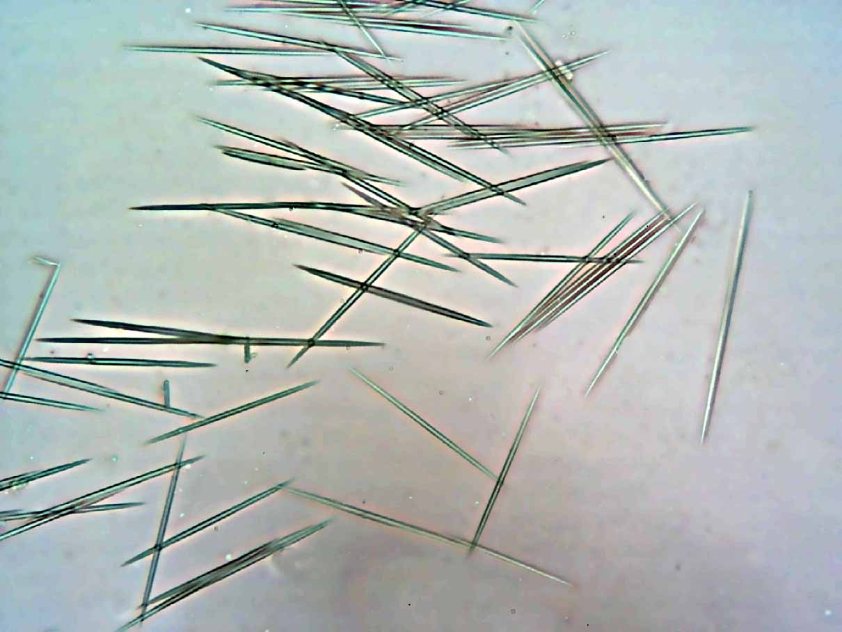 Raphides oxalates de calcium